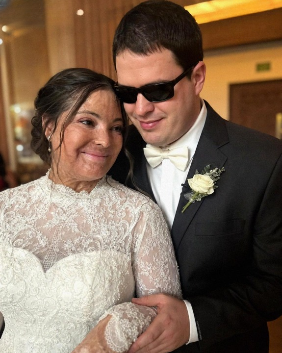 I married a blind man so he would never see my scars—then, on our wedding night, he told me, “There’s something you need to know… a truth I’ve been hiding for 20 years.”