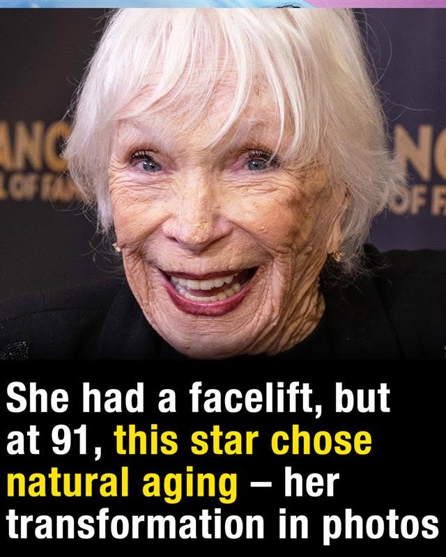 Shirley MacLaine opens up about the reality behind her age-defying transformation at 91 and the secrets of a Hollywood icon who continues to shine without fading.