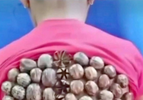 THE HIDDEN SKIN CONDITION AFFECTING MILLIONS OF PEOPLE RIGHT NOW